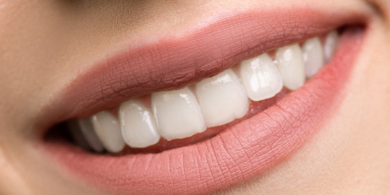 Tandkroner: En behandling der er til at betale